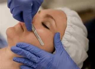 Dermaplaning